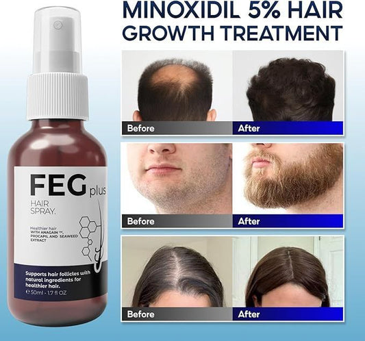 FEG Hair Growth Spray PLUS – Advanced Hair Regrowth & Anti-Hair Fall Treatment (Orginal)