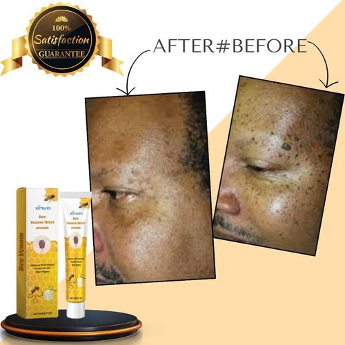 Tag Recede - Bee Venom Repair Spray (Original)